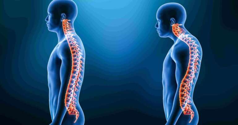 A importância da avaliação postural na fisioterapia